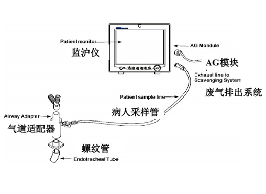 先鋒科技探測器、光學元件為麻醉氣體濃度監(jiān)測提供解決方案